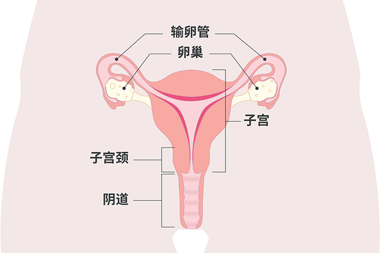 女性生殖系统图，图中为阴道、宫颈、子宫、卵巢和输卵管。