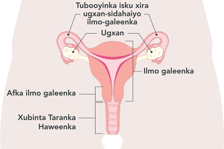 Diagram of the uterus with Somali labels