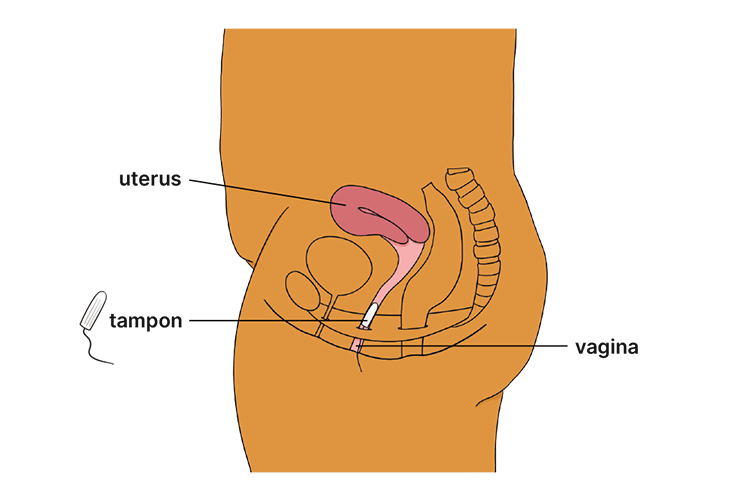 Tampon Diagram